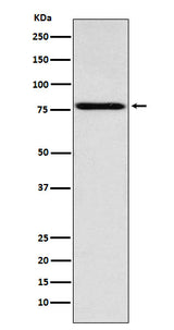 Anti-Coilin Rabbit Monoclonal Antibody Boster Bio