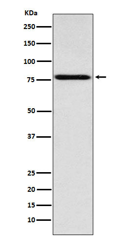 Anti-Coilin Rabbit Monoclonal Antibody Boster Bio