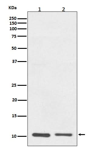Anti-S100A10 Rabbit Monoclonal Antibody Boster Bio