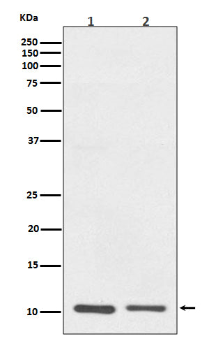 Anti-S100A10 Rabbit Monoclonal Antibody Boster Bio