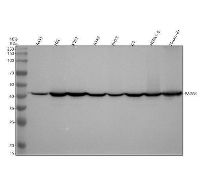 Anti-EBP1 / PA2G4 Rabbit Monoclonal Antibody Boster Bio