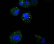 Anti-ATF5 Rabbit Monoclonal Antibody Boster Bio