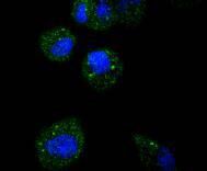 Anti-ATF5 Rabbit Monoclonal Antibody Boster Bio