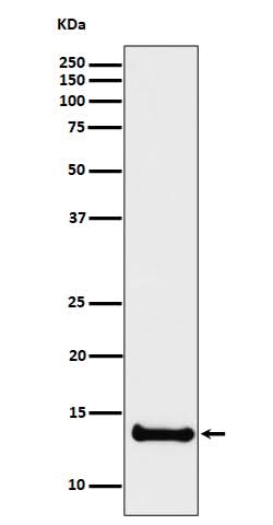 Anti-Cystatin B Rabbit Monoclonal Antibody Boster Bio