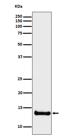 Anti-Cystatin B Rabbit Monoclonal Antibody Boster Bio