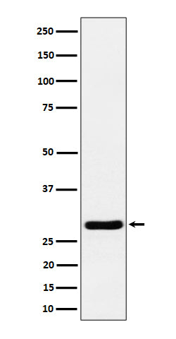 Anti-Calcipressin 1 Rabbit Monoclonal Antibody Boster Bio