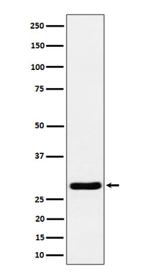 Anti-Calcipressin 1 Rabbit Monoclonal Antibody Boster Bio
