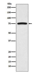 Anti-FRS2 Monoclonal Antibody Boster Bio