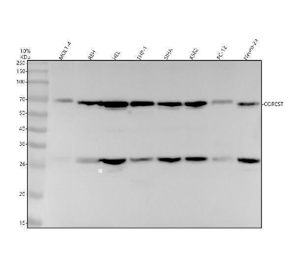Anti-CoREST Rabbit Monoclonal Antibody Boster Bio