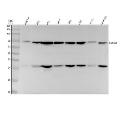 Anti-CoREST Rabbit Monoclonal Antibody Boster Bio