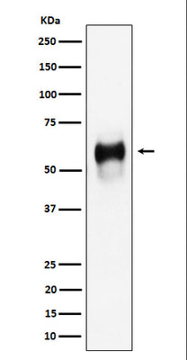 Anti-CD58 Rabbit Monoclonal Antibody Boster Bio