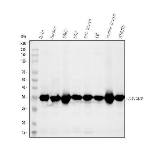 Anti-PPP1CA+PPP1CB Rabbit Monoclonal Antibody Boster Bio