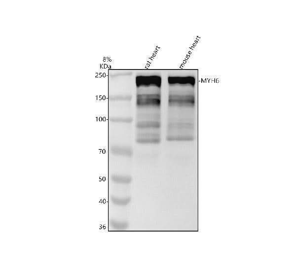 Anti-Myosin heavy chain MYH6 Rabbit Monoclonal Antibody Boster Bio