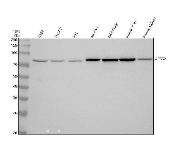 Anti-ACSS2/Acetyl Coa Synthetase Rabbit Monoclonal Antibody Boster Bio