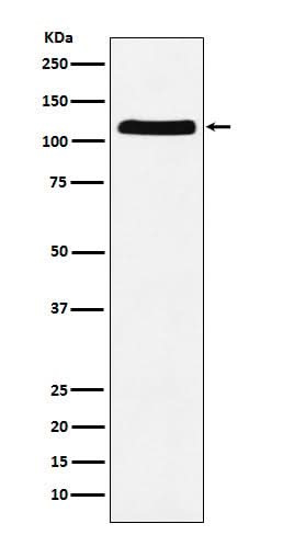 Anti-E1 Ubiquitin Activating Enzyme Rabbit Monoclonal Antibody Boster Bio