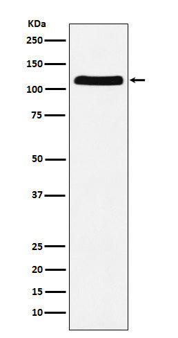Anti-E1 Ubiquitin Activating Enzyme Rabbit Monoclonal Antibody Boster Bio