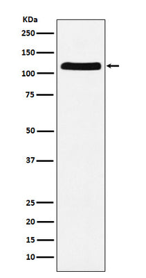 Anti-E1 Ubiquitin Activating Enzyme Rabbit Monoclonal Antibody Boster Bio