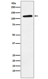 Anti-Eph receptor B1 Rabbit Monoclonal Antibody Boster Bio