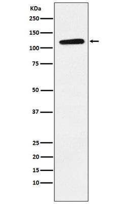 Anti-Eph receptor B1 Rabbit Monoclonal Antibody Boster Bio
