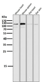 Anti-ERK5 Rabbit Monoclonal Antibody Boster Bio