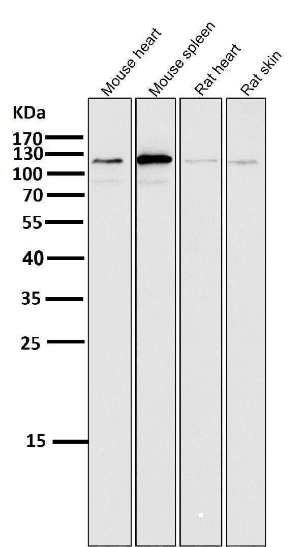 Anti-ERK5 Rabbit Monoclonal Antibody Boster Bio