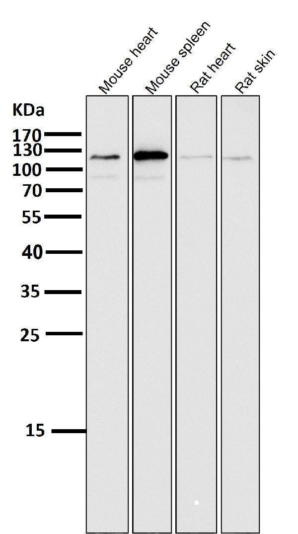 Anti-ERK5 Rabbit Monoclonal Antibody Boster Bio