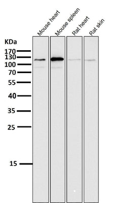 Anti-ERK5 Rabbit Monoclonal Antibody Boster Bio