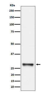 Anti-PNMT Rabbit Monoclonal Antibody Boster Bio