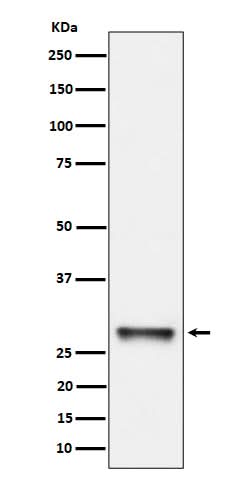 Anti-PNMT Rabbit Monoclonal Antibody Boster Bio