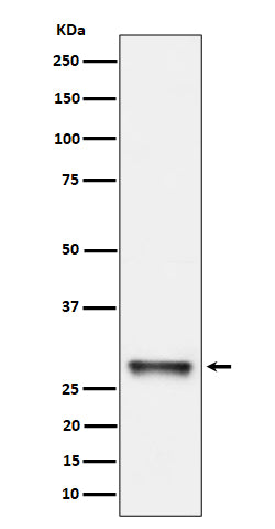 Anti-PNMT Rabbit Monoclonal Antibody Boster Bio
