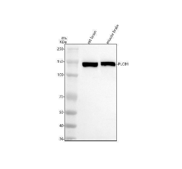 Anti-PLCB1 Rabbit Monoclonal Antibody Boster Bio