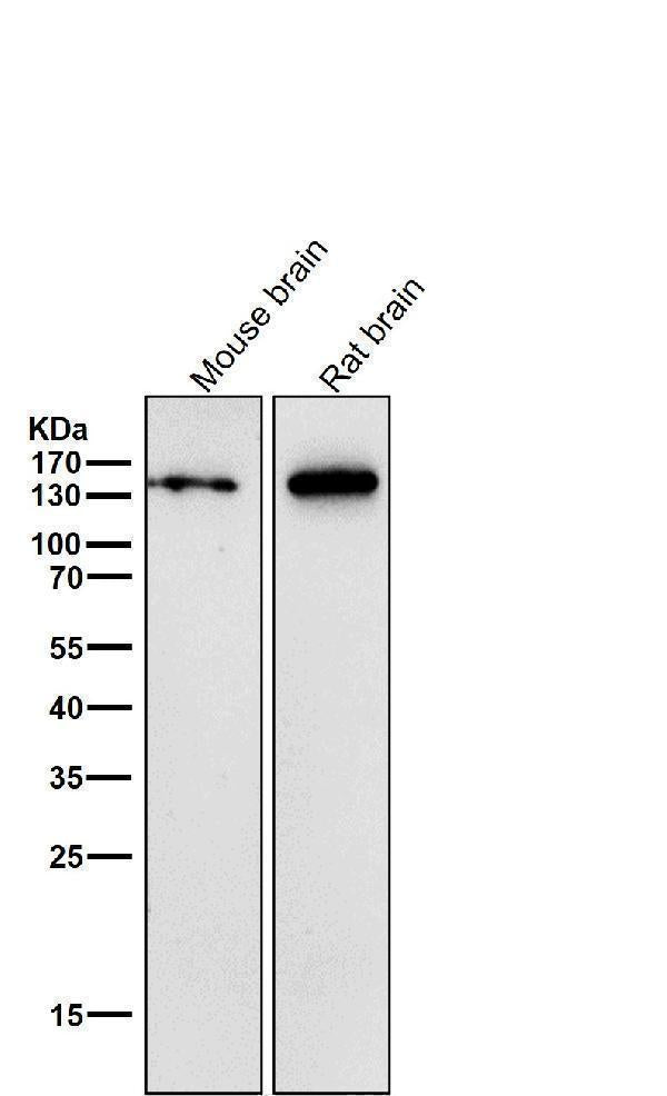 Anti-CNTP2 Rabbit Monoclonal Antibody Boster Bio