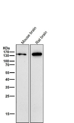 Anti-CNTP2 Rabbit Monoclonal Antibody Boster Bio