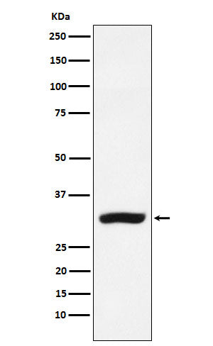 Anti-CBR1 Rabbit Monoclonal Antibody Boster Bio