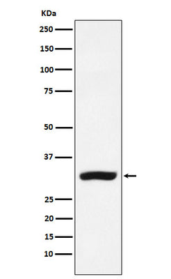 Anti-CBR1 Rabbit Monoclonal Antibody Boster Bio