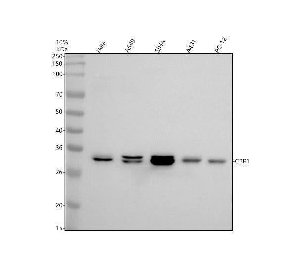 Anti-CBR1 Rabbit Monoclonal Antibody Boster Bio