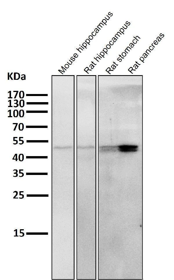 Anti-Cytokeratin 20 KRT20 Rabbit Monoclonal Antibody Boster Bio