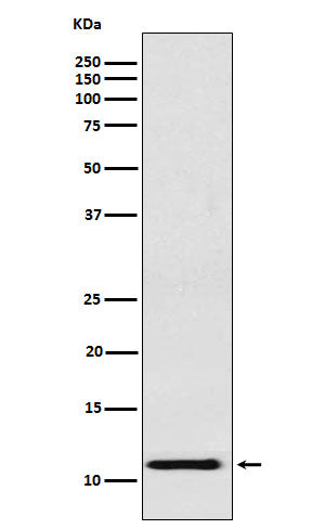 Anti-fetal hemoglobin Rabbit Monoclonal Antibody Boster Bio