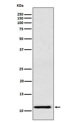 Anti-fetal hemoglobin Rabbit Monoclonal Antibody Boster Bio