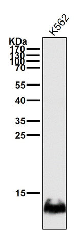 Anti-HBG1/2 Rabbit Monoclonal Antibody Boster Bio