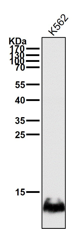 Anti-HBG1/2 Rabbit Monoclonal Antibody Boster Bio