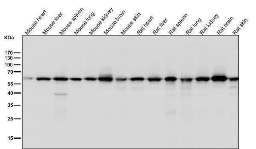 Anti-KAT9 / Elp3 Rabbit Monoclonal Antibody Boster Bio