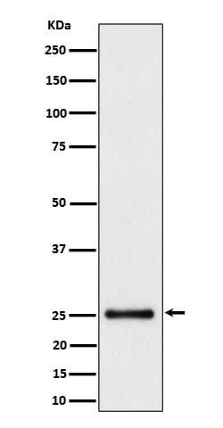 Anti-HMG4 Rabbit Monoclonal Antibody Boster Bio