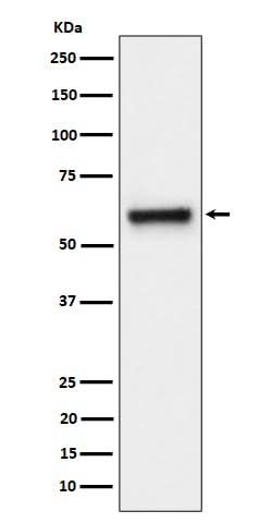 Anti-FPGS Rabbit Monoclonal Antibody Boster Bio