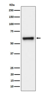Anti-FPGS Rabbit Monoclonal Antibody Boster Bio