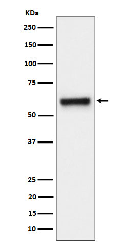 Anti-FPGS Rabbit Monoclonal Antibody Boster Bio