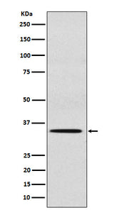 Anti-SULT2A1 Rabbit Monoclonal Antibody Boster Bio