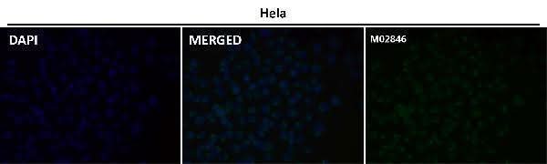 Anti-PSMA FOLH1 Rabbit Monoclonal Antibody Boster Bio