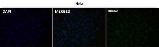 Anti-PSMA FOLH1 Rabbit Monoclonal Antibody Boster Bio
