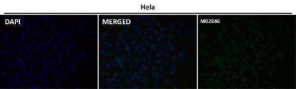 Anti-PSMA FOLH1 Rabbit Monoclonal Antibody Boster Bio